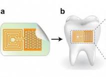 Tooth sensor that detects harmful bacteria | Innovation Essence