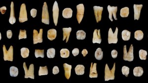 _86124312_human-teeth