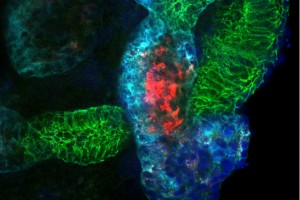 Bonventre-injured-tubules605