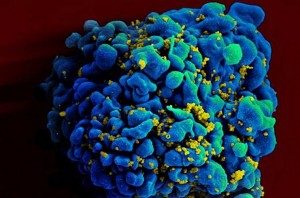 hiv-sugar-study-759x500