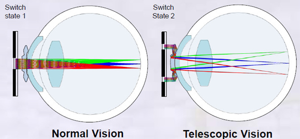 Where To Buy Telescopic Contact Lens