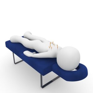 acupuncture1