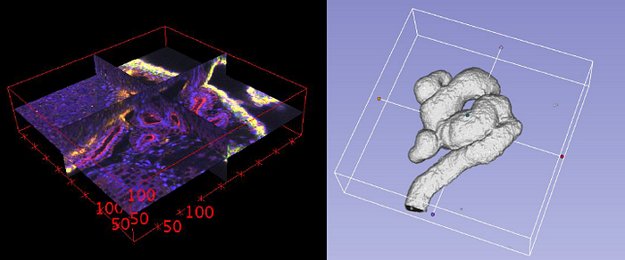 ‘3D U-Net’ – Convolutional Neural Network That Was Developed For ...