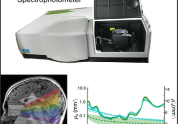University of Glasgow — beamed light through a human head marking a major leap in non-invasive brain imaging.