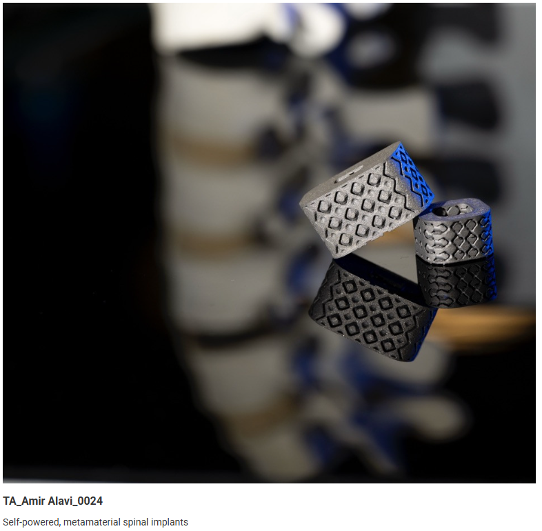 University of Pittsburgh – Amir Alavi & team have Build a Wireless Metamaterial Interbody Cage for Real-Time Assessment of Lumbar Spinal Fusion In Vivo
